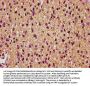 GFAP Antibody