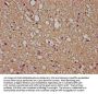 GFAP Antibody