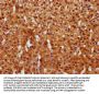 GGCT Antibody