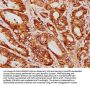 GGCT Antibody