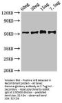 Gamma-glutamyl hydrolase Antibody