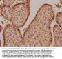 GH1 Antibody
