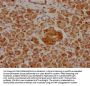 GIP Antibody