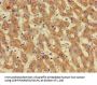GIPC1 Antibody
