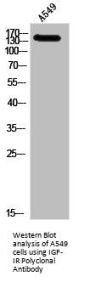IGF1R Antibody