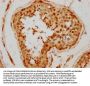 GLI4 Antibody