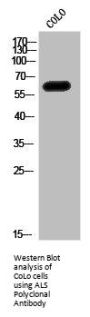 IGFALS Antibody