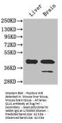 GLUL Antibody