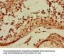 GNA11 Antibody