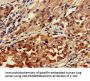 GNAT1 Antibody