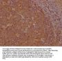 GNLY Antibody