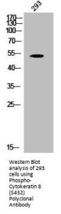 Phospho-KRT8 (S432) Antibody
