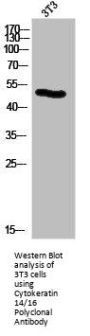 KRT14/KRT16 Antibody