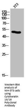 KRT14/KRT16 Antibody