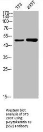 Phospho-KRT18 (S52) Antibody