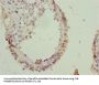 GOSR2 Antibody