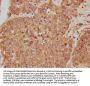 Rabbit anti-human Aspartate aminotransferase, cytoplasmic polyclonal Antibody