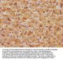 Rabbit anti-human Aspartate aminotransferase, cytoplasmic polyclonal Antibody