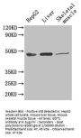 Rabbit anti-human Aspartate aminotransferase, cytoplasmic polyclonal Antibody