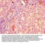 GRK2 Antibody