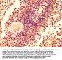 GRK2 Antibody