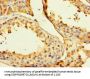 GPD2 Antibody