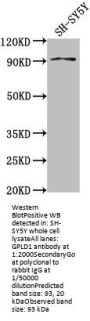 GPLD1 Antibody