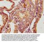 GPLD1 Antibody