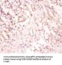 SNRPA Antibody
