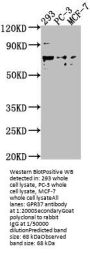 GPR37 Antibody