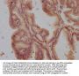 GPR55 Antibody