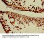 GPR85 Antibody