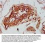 GREM1 Antibody