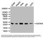 GSTM3 Antibody