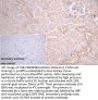 GSTM3 Antibody
