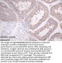 GSTM3 Antibody