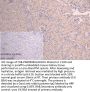 GSTM3 Antibody