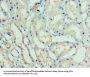 GTF2H5 Antibody
