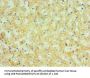 GUSB Antibody
