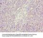 GZMH Antibody