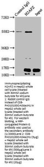 Acetyl-H2AFZ (K4) Antibody