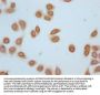Acetyl-H2AFZ (K4) Antibody