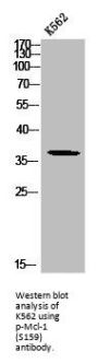 Phospho-MCL1 (S159) Antibody