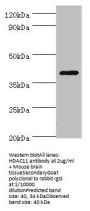 HDAC11 Antibody