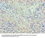 HDAC3 Antibody