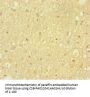 HDAC5 Antibody