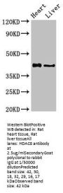 HDAC8 Antibody