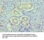 HDAC8 Antibody