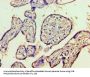 HDAC8 Antibody