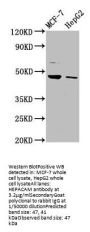 HEPACAM Antibody